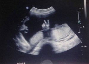 peace-off